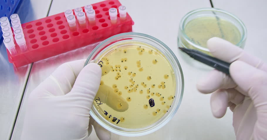 Lab assistant marks notes near bacteria colonies growing in various ways in medical center. Conducting experiment with microorganisms Royalty-Free Stock Footage #3494974261