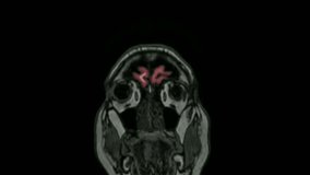 MRI brain scan magnetic resonance imaging top Neurology data analysis process Diagnosis of disease