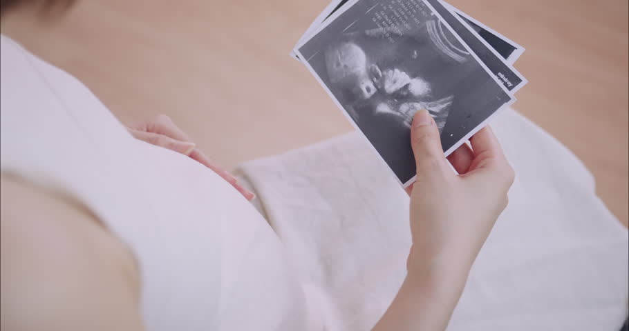 Happy pregnant woman looks at ultrasound image of her baby on the sofa at home.
