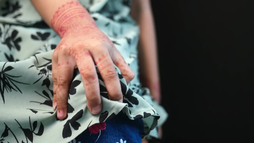  little girl suffering knee joint pain