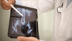 A physician is focused on a hip x-ray displayed on a digital tablet, utilizing a stylus to highlight areas for diagnosis in a clinical setting - Powered by Shutterstock - Get 15% off with code: PIKWIZARD15
