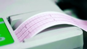 Electrocardiograph EKG or ECG diagram printed on grid paper. Electro cardiography histogram printed on paper, heart rhythm ekg note on paper, heart rate measure document, arrhythmia concept.