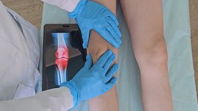 Doctor holding x-ray and examines child leg. Knee pain in teenagers arthritis and meniscus causes treatment - Powered by Shutterstock - Get 15% off with code: PIKWIZARD15