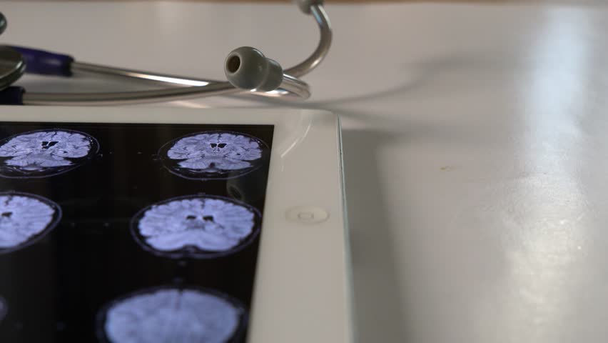 CT scan image on Magnetic Resonance Imaging (MRI) on digital tablet