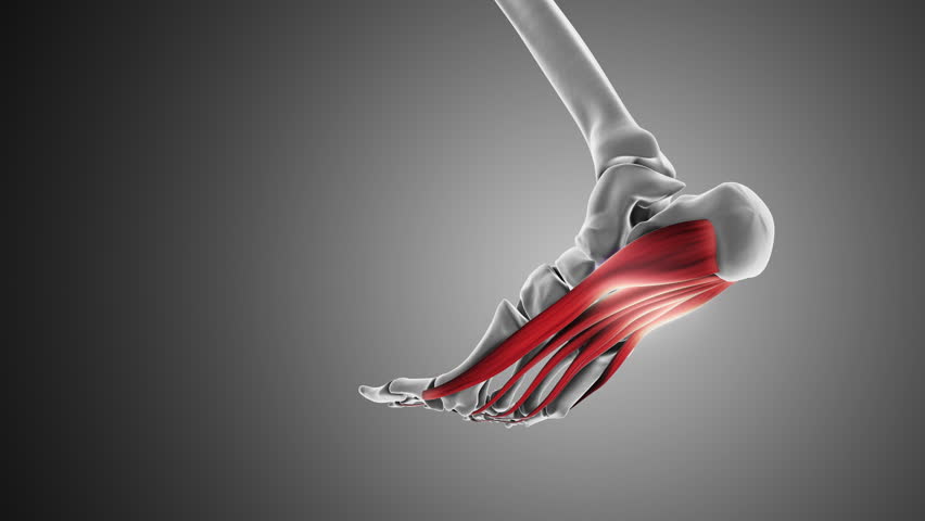 Plantar fascia dysfunction medical animation