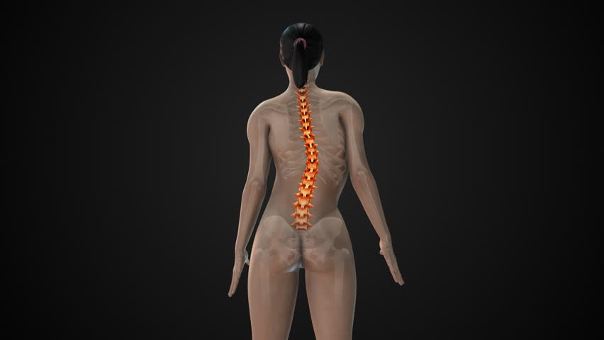 Scoliosis of the spine medical condition