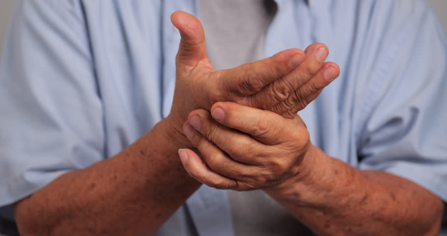 An Asian man has tingling and numbness in his hand which causes beriberi.
