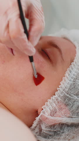 Beauty treatment, enzyme therapy. Skilled beautician applying hydrating medical peeling cream mask to a young woman face, focusing on cheeks. Pampering spa dermapen procedure for youthful skin care