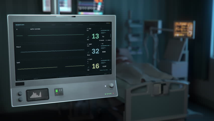 Medical clinic equipment is monitoring the patients health. Medical monitoring equipment detects the rapid decrease of heart rate in a clinic. Medical clinic equipment shows the pulse flatline. Death.