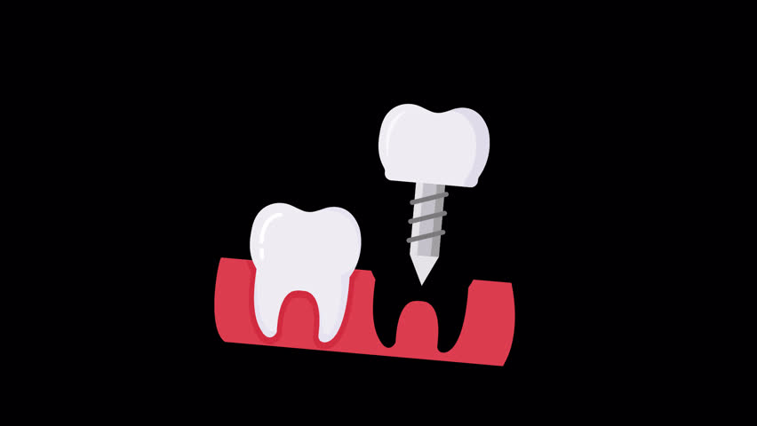 animation dental medical healthy motion graphic