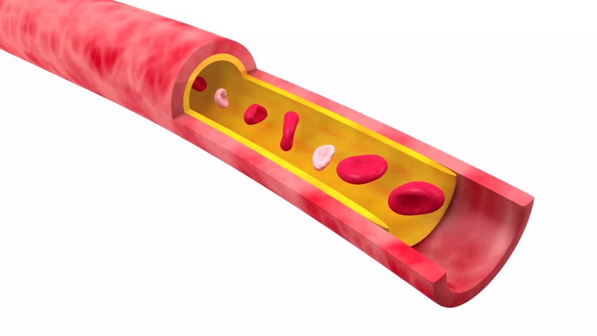Anatomical 3D animation of the artery with the movement of obstruction due to accumulated fat. Slows down red blood cells in blood circulation. Capillary cut out on white background.