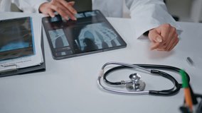 Doctor hands touching x-ray on digital tablet at clinic office closeup. Unrecognizable healthcare professional scrutinizing medical images. Expert physician examining radiology results for diagnosis. - Powered by Shutterstock - Get 15% off with code: PIKWIZARD15