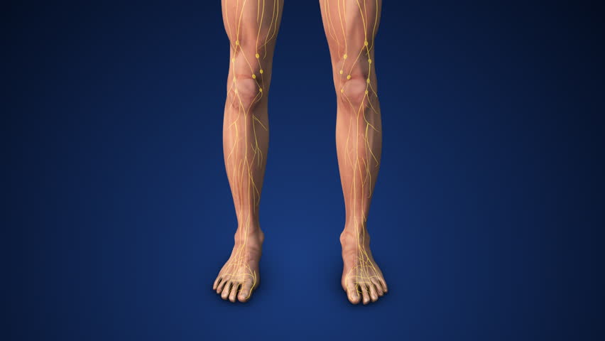 Medical animation of lymphedema in the legs