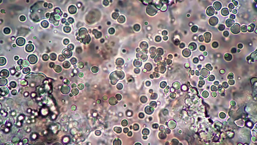 A telescopic footage of some anonymous bacteria moving under telescope