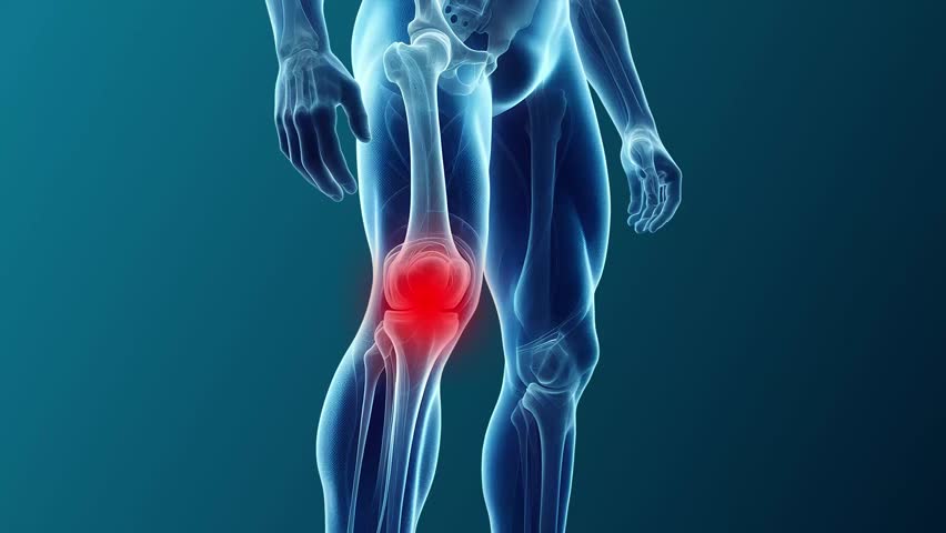 Arthritis Pain in Knees Animation