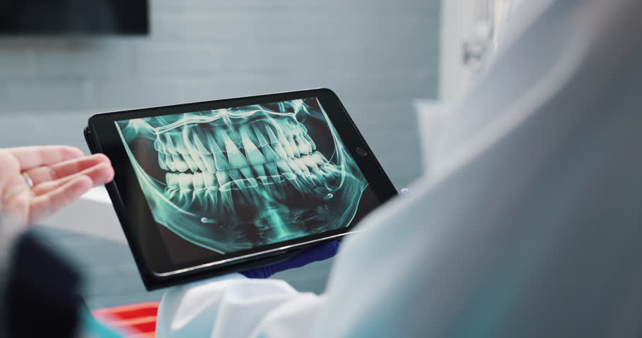 Hands, dentist and tablet screen in healthcare for x ray, teeth diagnosis and plan for treatment. Clinic, patient and dental surgeon with digital for tooth structure, advice and orthodontic procedure