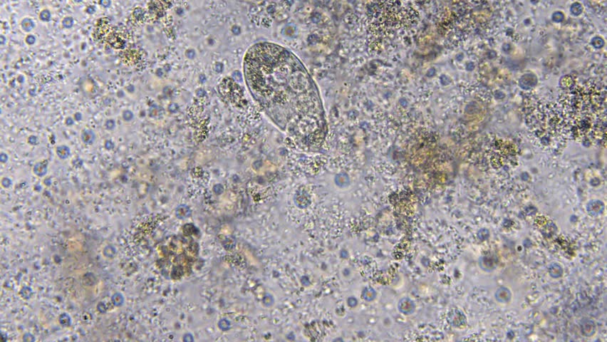 Life in a water droplet under a microscope, showing bacteria, microorganisms, and plants. High magnification reveals paramecia and bacteria. Laboratory study of organic water contamination.