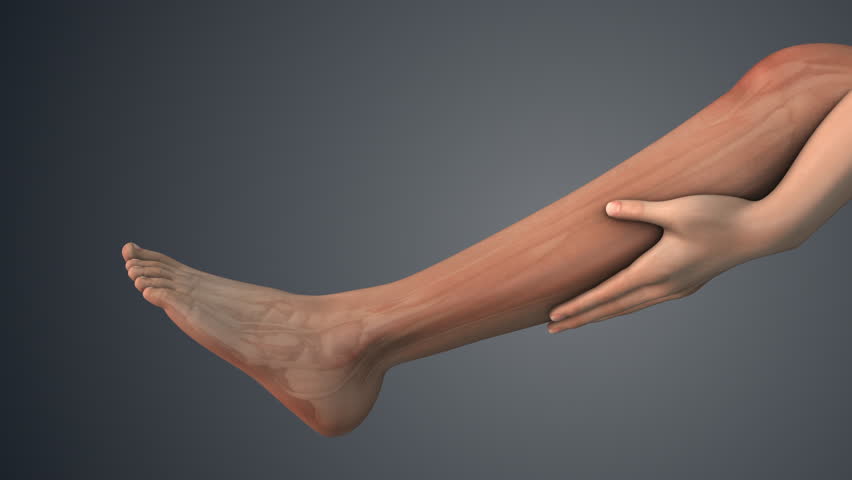 Muscle cramp in the leg