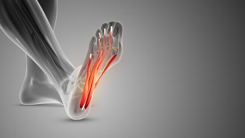 
The plantar fascia is a band of tissue