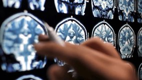 Doctor reading X-Ray while pointing it with a pencil. Analyzing Brain Scan MRI with tumor or cancer. Doctor looking at the brain scan that show on computer. - Powered by Shutterstock - Get 15% off with code: PIKWIZARD15