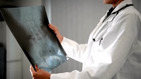 Video of Doctor in the hospital with an x-ray of a man's back. The doctor analyzes the x-ray of the spine. doctor checking spine x ray scan of patient. - Powered by Shutterstock - Get 15% off with code: PIKWIZARD15