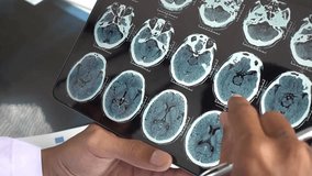 Digital tablet show CT Brain scan image on Magnetic Resonance Imaging (MRI). Analyzing brain disease. A Doctor examining MRI, CT scan image of human brain. - Powered by Shutterstock - Get 15% off with code: PIKWIZARD15