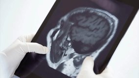 Unrecognizable doctor reviews and analyzing patient brain x-ray scan on digital tablet. Doctor Diagnosis with brain X-ray image on Digital Tablet. - Powered by Shutterstock - Get 15% off with code: PIKWIZARD15