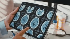 Doctor reviewing brain x-rays while MRI report of patient showing in digital tablet. Closeup of Doctor hand using Digital tablet to Analyzing x ray scan. - Powered by Shutterstock - Get 15% off with code: PIKWIZARD15