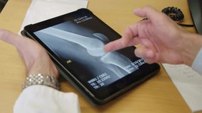 doctor of radiology looking at MRI image of human knee scan. doctor review knee x-ray in smart device. knee bones x-ray medical data on touchscreen tablet. - Powered by Shutterstock - Get 15% off with code: PIKWIZARD15