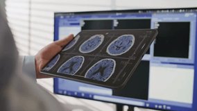 Closeup of Professional Surgeons looking at the brain scan show on a digital tablet. Doctor's hand using Digital tablet to Analyzing brain x ray image. - Powered by Shutterstock - Get 15% off with code: PIKWIZARD15