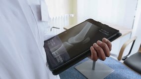 doctor of radiology looking at MRI image of human knee scan. doctor review knee x-ray in smart device. knee bones x-ray medical data on touchscreen tablet. - Powered by Shutterstock - Get 15% off with code: PIKWIZARD15