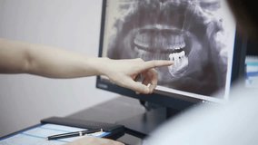 Shot of human teeth x-ray photograph. dental theme and dentist concept. doctor pointing at teeth x-ray image at digital tablet. panoramic mouth x-ray image. - Powered by Shutterstock - Get 15% off with code: PIKWIZARD15