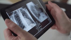 radiologist analyzing CT scan of a patient's lungs in hospital office. doctor medical examining x-ray of patient lungs on digital tablet screen, closeup. - Powered by Shutterstock - Get 15% off with code: PIKWIZARD15