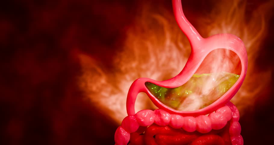 Gastric problem and stomach cramp symptoms focusing on acid reflux, upset stomach, and digestion pain inside the digestive tract, visualized through detailed 3D Rendering.
