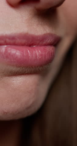 Vertical video. Woman showing dental braces emphasizing orthodontic treatment. Concept of dental health, oral hygiene and self-esteem. Focus on woman's mouth and braces. Wax for teeth or braces.