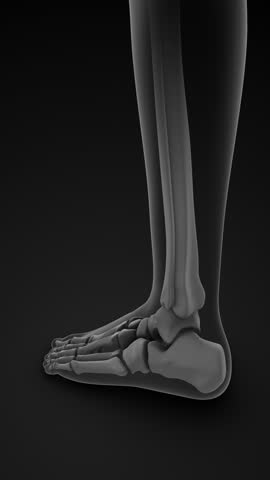 Chronic Ankle Joint Pain and Inflammation Syndrome