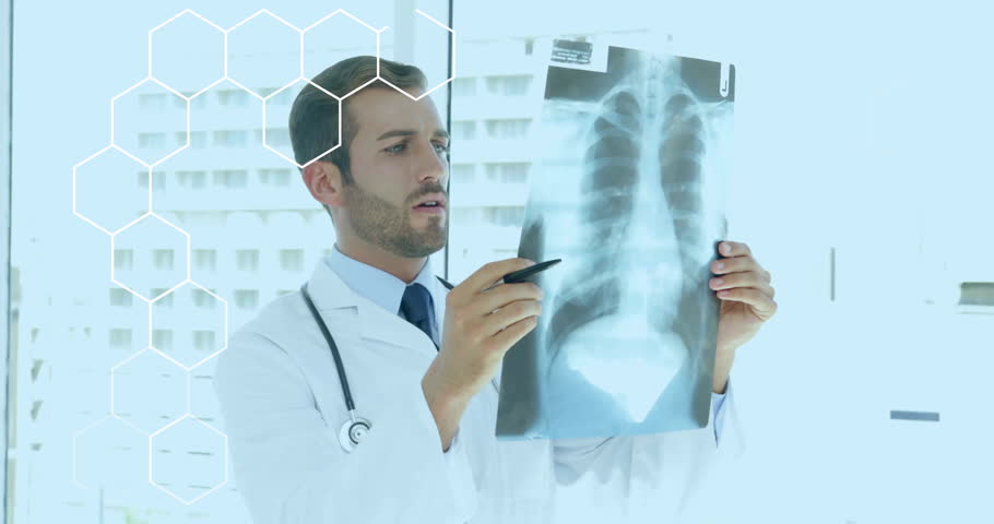 Doctor examining chest X-ray, medical analysis animation over hexagonal shapes. Healthcare, diagnosis, radiology, examination, technology, innovation