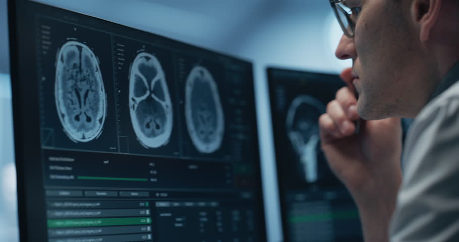 Physician Examines Brain Scans on Computer Screen, Focusing on Healthcare Science and Medicine. Glasses Reflect Medical Images and Neurological Data. Cinematic Arc shot Close-up Portrait