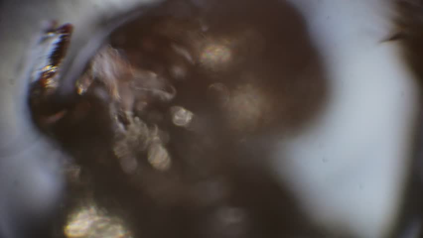 African wasp in extreme macro, filmed through a microscope. The wasp moves erratically with shallow depth of field, revealing intricate details of its eyes, hairs, and body.