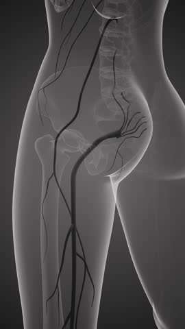 Sciatic nerve pain in lower back