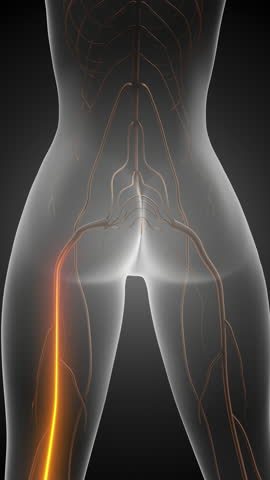 Lower back to leg pain due to sciatica