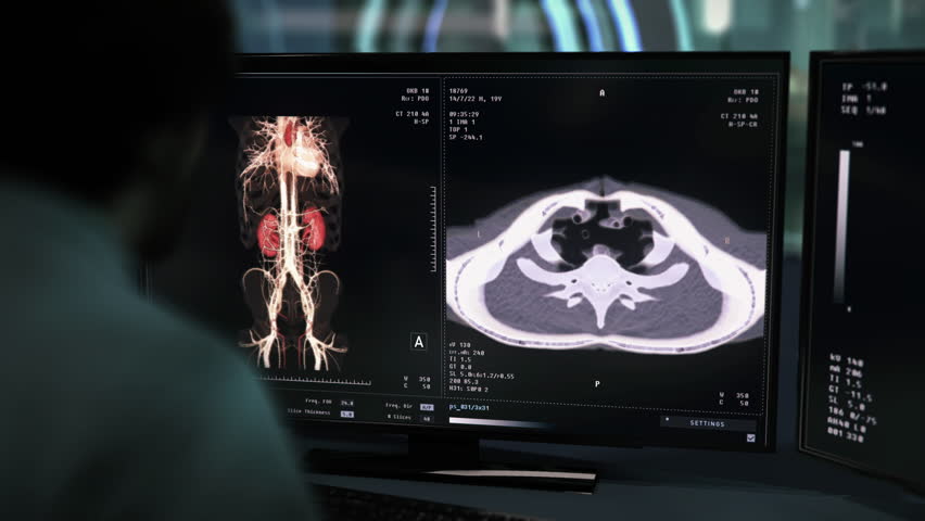 X-ray Disease Diagnosis Software Used By Doctor To Examine Kidneys. Checking Internal Organs For Disease With X-ray Scan. Medical Diagnosis. X-ray Examination For Disease Diagnosis. Hospital