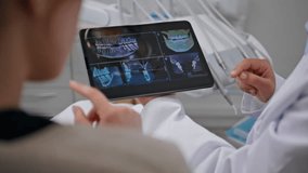 Orthodontist explaining dental x-ray results to patient on tablet clinic closeup. Unknown professional dentist analyzing oral cavity health using digital tools. Woman doctor advising teeth treatment. - Powered by Shutterstock - Get 15% off with code: PIKWIZARD15