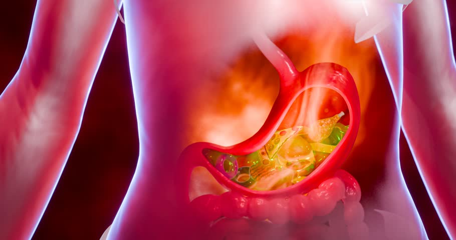 Indigestion and digestive system issues conceptualized with detailed stomach pain, gastric acid overflow, and gastrointestinal disorder effects portrayed in vivid 3D Rendering.
