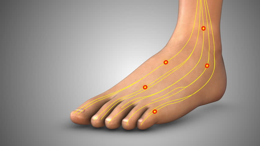 Numbness and tingling in foot