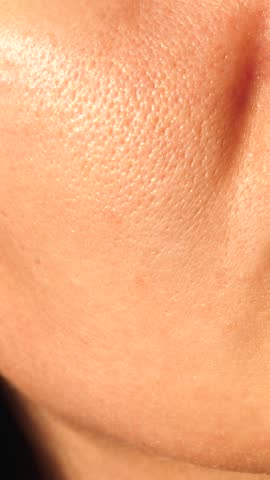 short vertical video skin texture with enlarged pores. concept of cosmetic procedures, acne and enlarged pores treatment