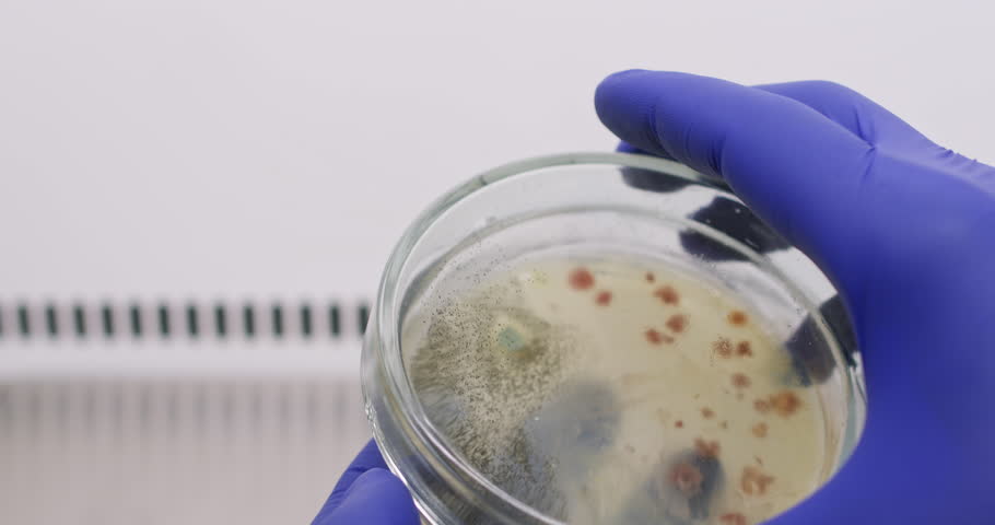 A scientist opens a petri dish where bacteria and black mold have grown. Analysis of bacterial growth in mold contamination.