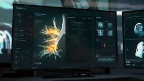 Molecular Analysis Software In Modern Hospital Checks Respiratory Organ For Cancer Illness. Molecular Analysis Of Dangerous Illness Growth. Futuristic Molecular Analysis Interface. Illness Examination - Powered by Shutterstock - Get 15% off with code: PIKWIZARD15