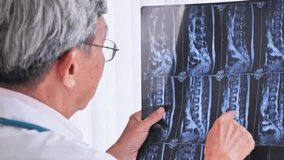 Video of Doctor in the hospital with an x-ray of a man's back. The doctor analyzes the x-ray of the spine. doctor checking spine x ray scan of patient. - Powered by Shutterstock - Get 15% off with code: PIKWIZARD15