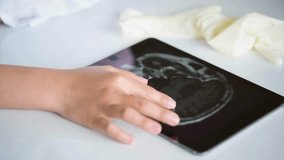 Unrecognizable doctor reviews and analyzing patient brain x-ray scan on digital tablet. Doctor Diagnosis with brain X-ray image on Digital Tablet. - Powered by Shutterstock - Get 15% off with code: PIKWIZARD15